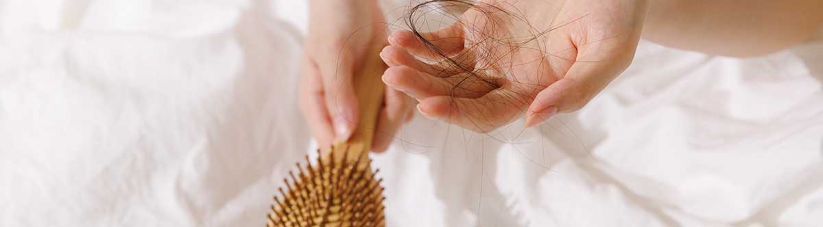 여성탈모이미지